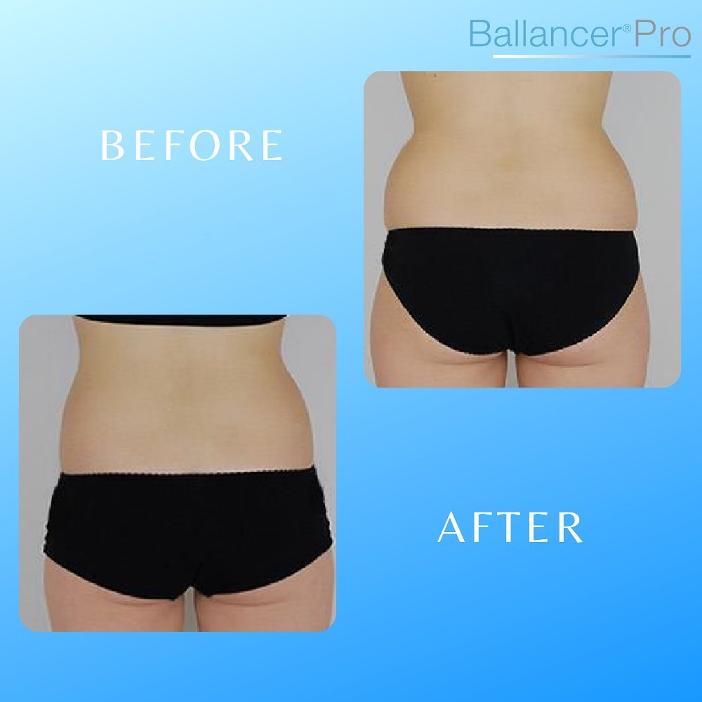 relieved muscle pain with Ballancer PRO