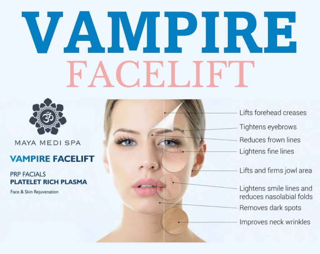 VAMPIRE FACELIFT BY MAYA MEDISPA Maya Medi Spa | Best Beauty Clinic in India