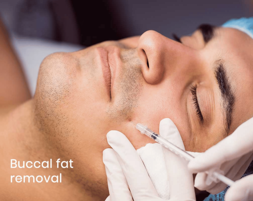 What is Buccal Fat Removal Maya Medi Spa | Best Beauty Clinic in India