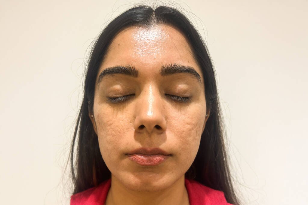 Mermaid Facial